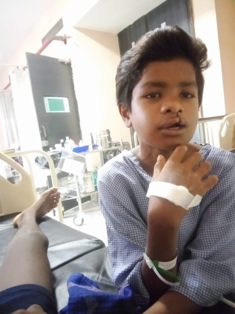 ‘चिरायु’ दल ने जन्मजात क्लेफ्ट लिप एवं पैलेट से पीड़ित बालक को दिलाई नई मुस्कान